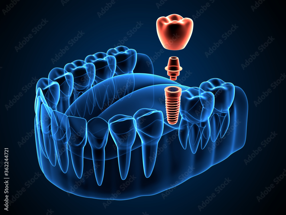 AdobeStock_362244721_Preview Risques orthodontie praticien non spécialisé — consultation spécialiste qualifié Orthodent